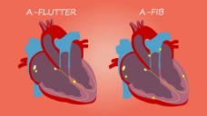 心脏器官视频素材