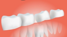 白色牙齿医疗视频